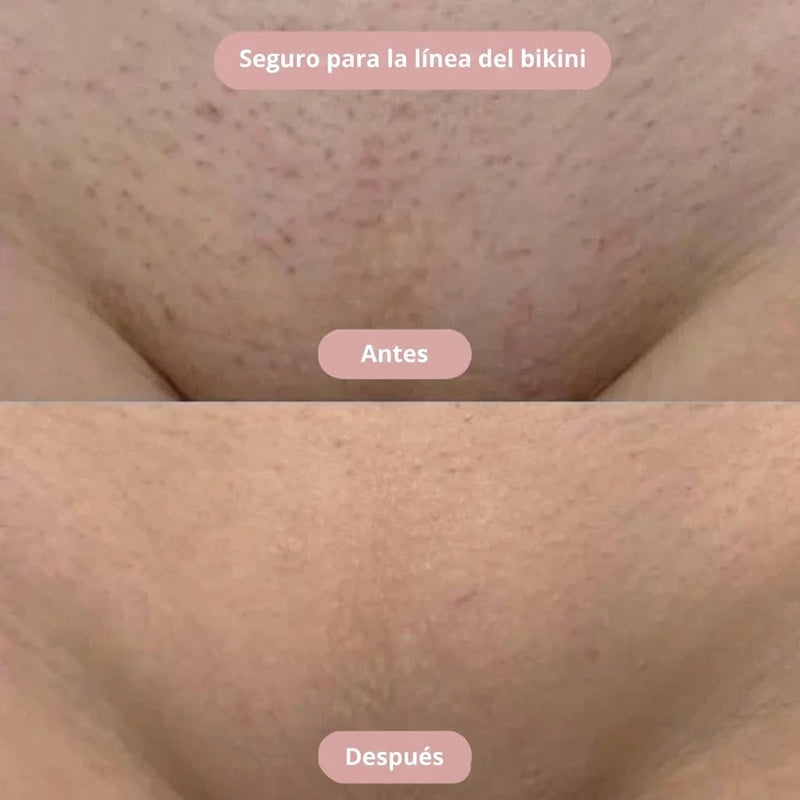 Silkyskin - Limpieza íntima sin irritación