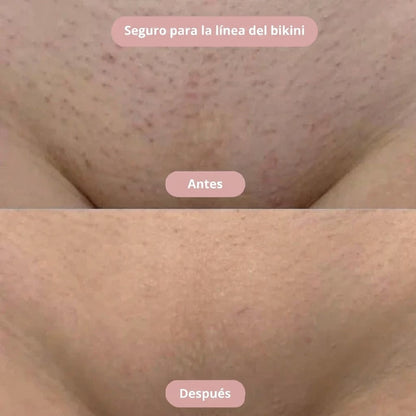 Silkyskin - Limpieza íntima sin irritación